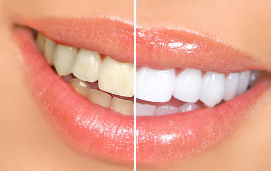 Cosmetic Dentistry