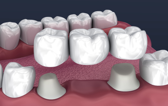 Restorative Dentistry